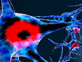 Blue and red rendering of brain neurons.