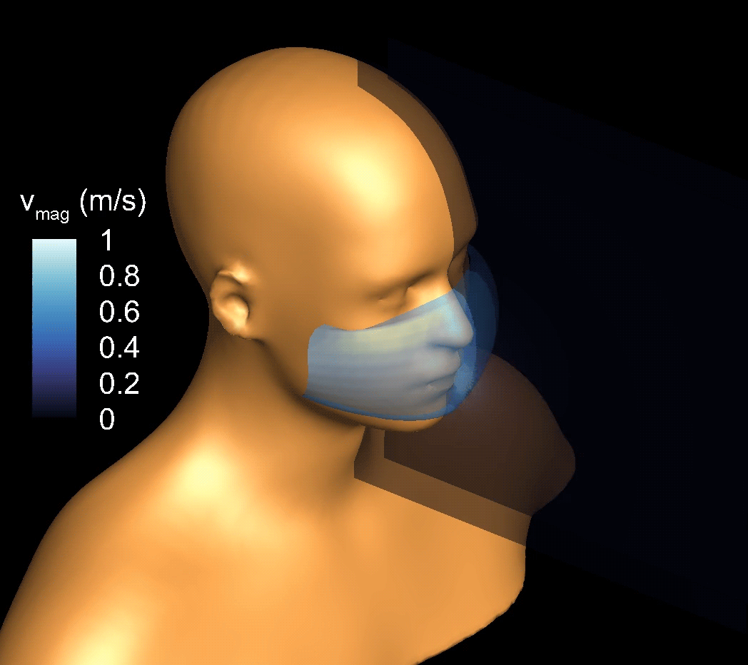 A computational simulation of a cough shows the airflow velocity of droplets moving through a simple face mask.
