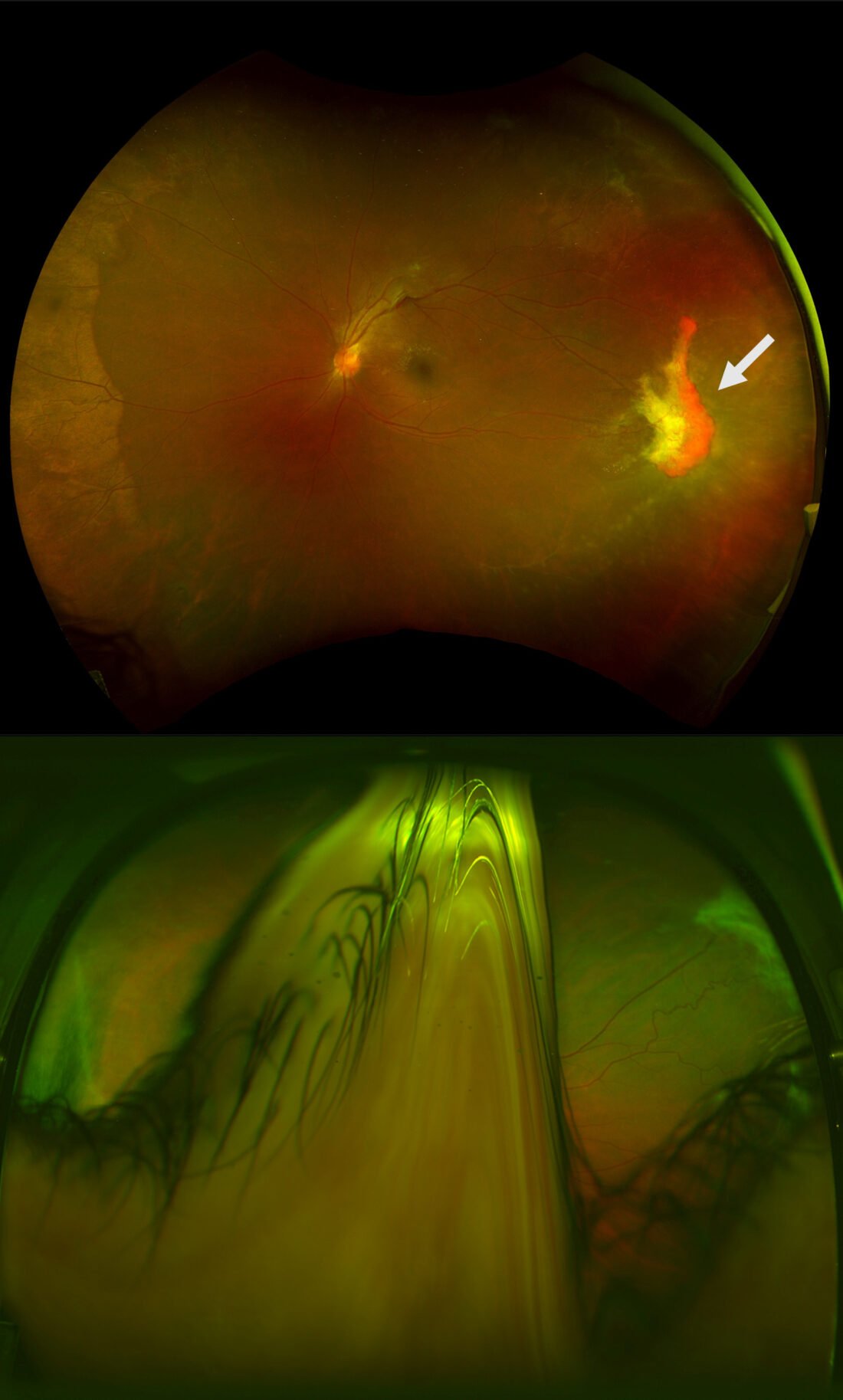 Johns Hopkins researchers receive Retina Society grant Johns Hopkins