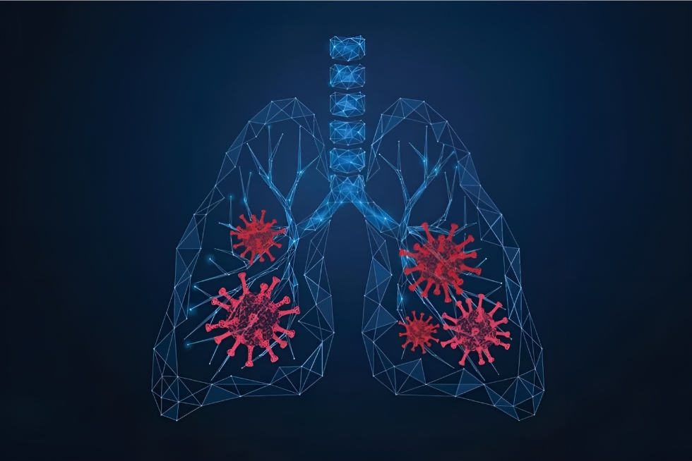Illustration of human lungs affected by coronavirus.