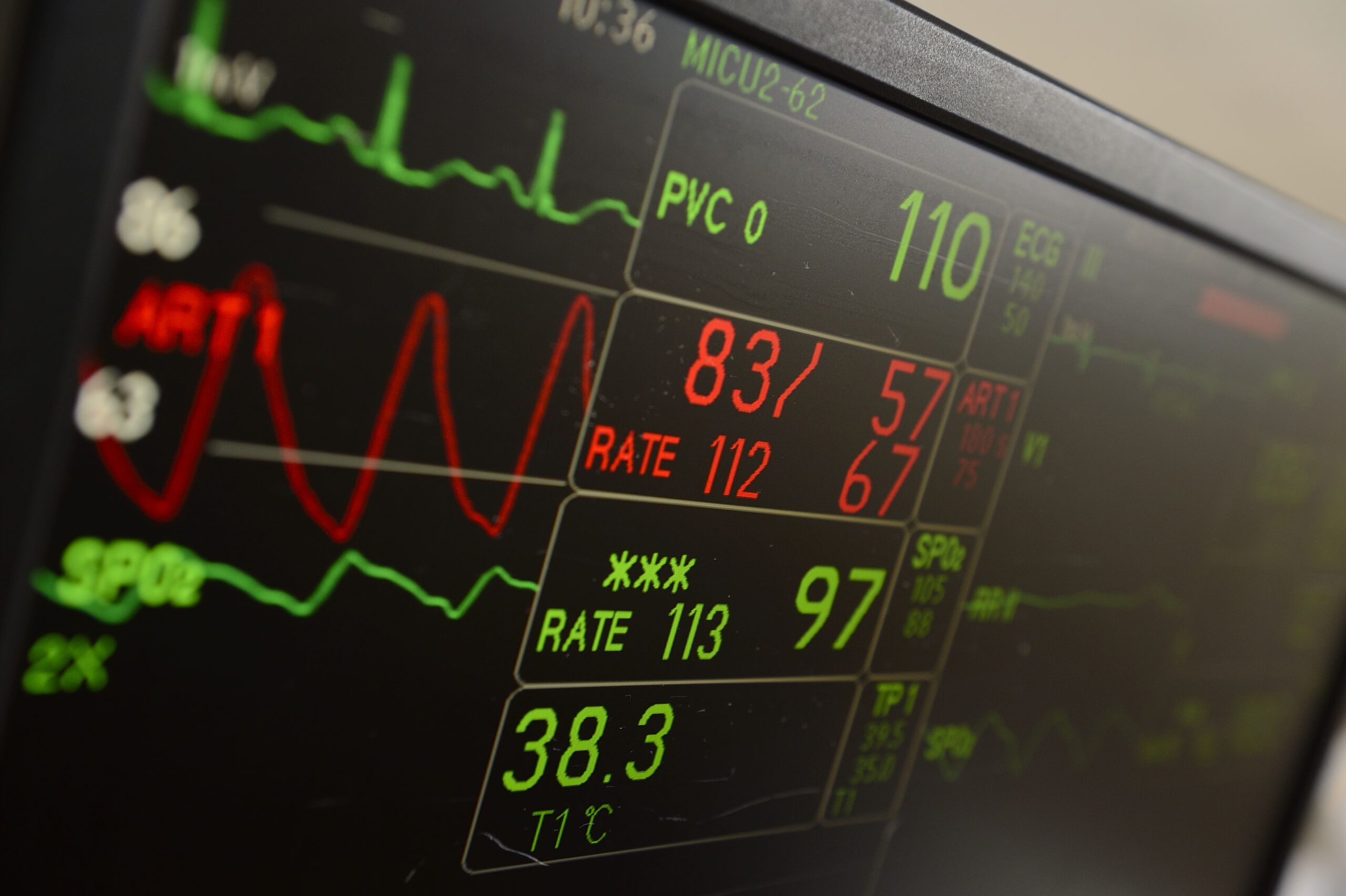 Close-up of a vitals monitor.